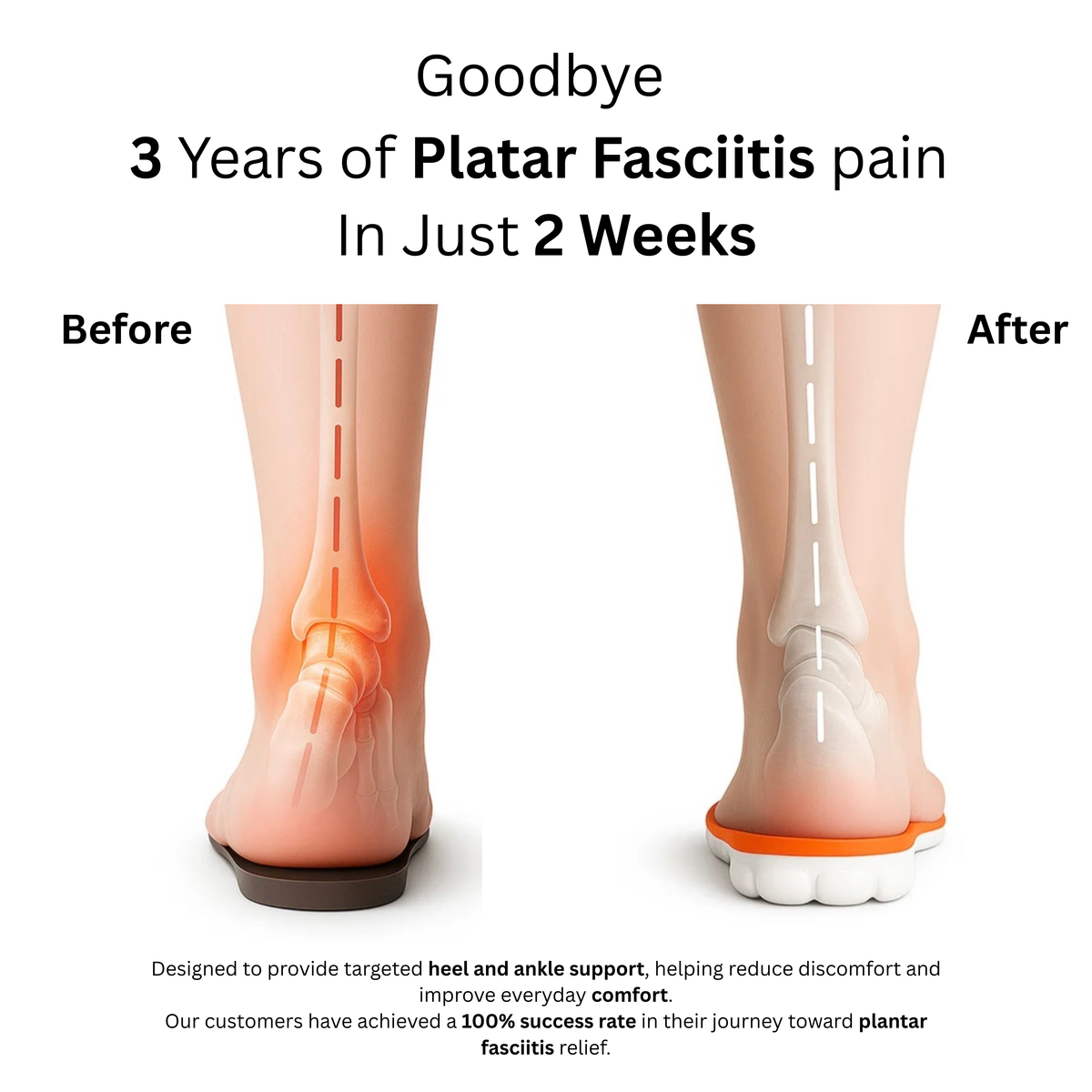 Ankle & Heel Support